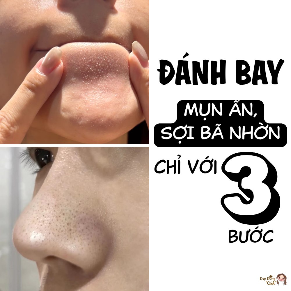 Giải Pháp Giảm Sợi Bã Nhờn An Toàn Cho Da Dầu
