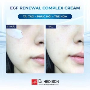 Kem dưỡng tái tạo tế bào gốc EGF Renewal Complex Cream Dr.Hedison 50ml