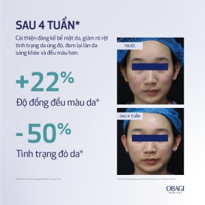 Obagi Medical Retinol + PHA