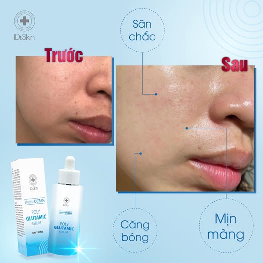 Serum cấp ẩm Idr.skin Hydro Ocean Poly Glutamic Serum cho da ẩm mượt (IDr Skin)