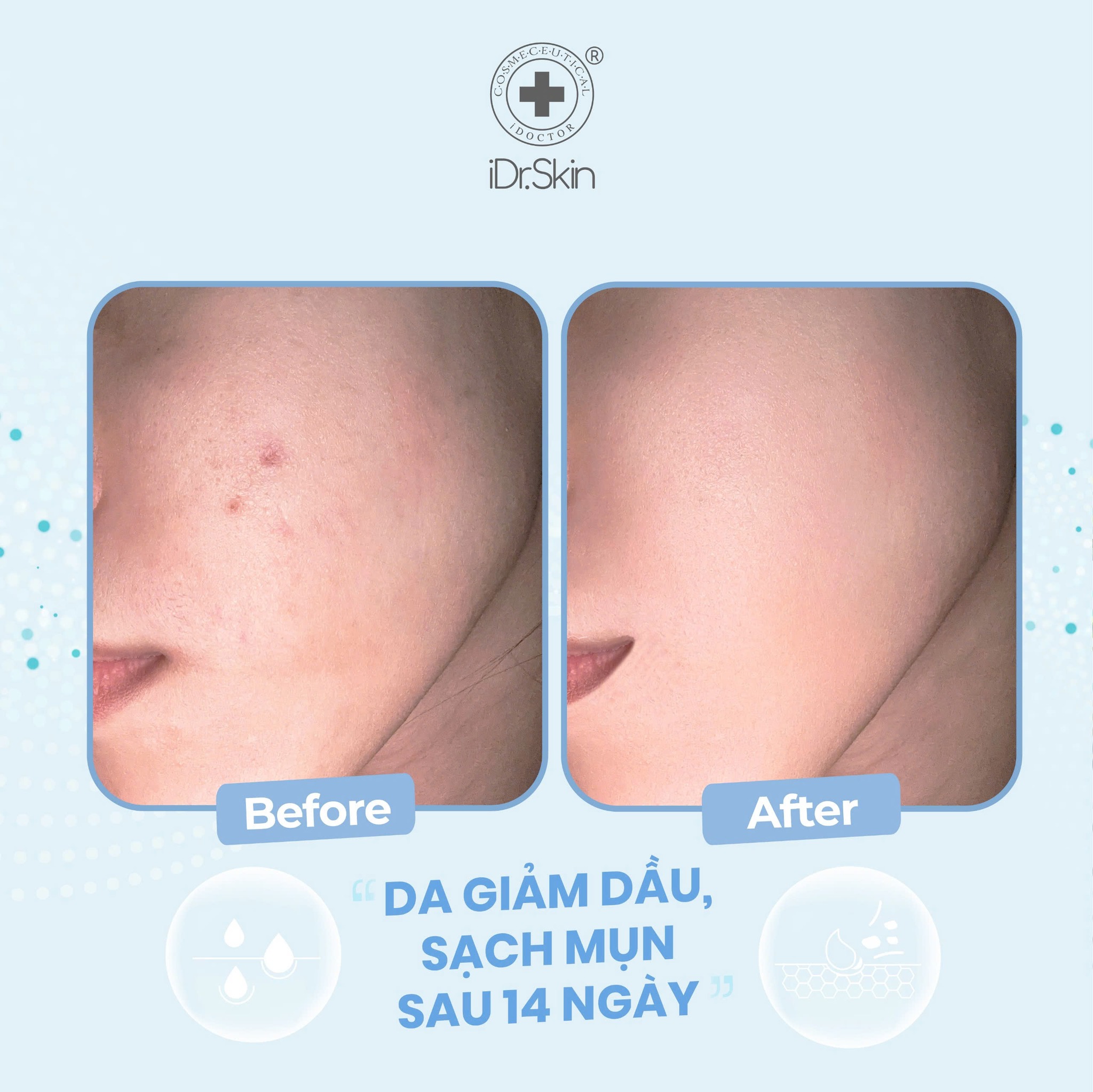 Sữa rửa mặt loại bỏ dầu Idr.Skin Facial Cleansing Gel - Ảnh 6