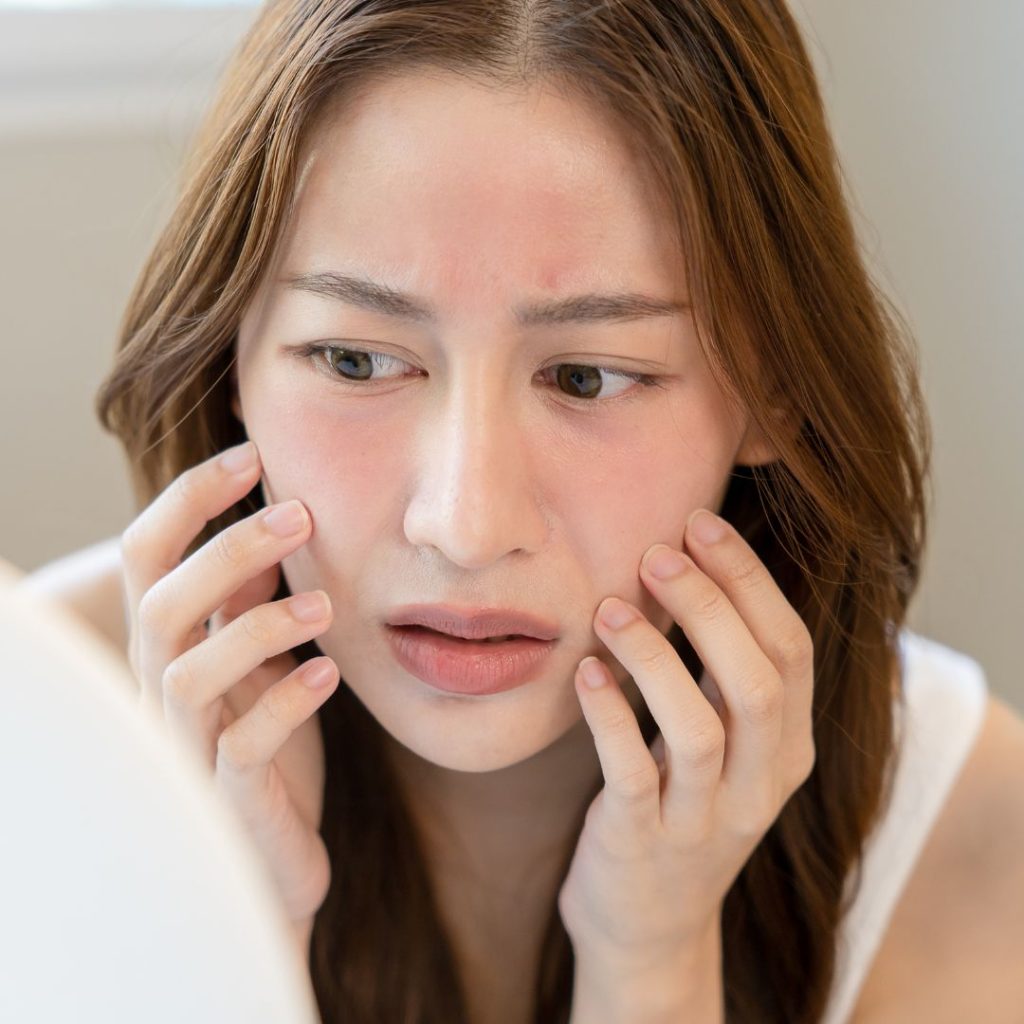 Dấu Hiệu Da Không Phù Hợp Với Retinol