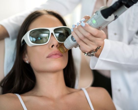 Laser Toning Có Trị Được Tàn Nhang Và Đốm Nâu Không