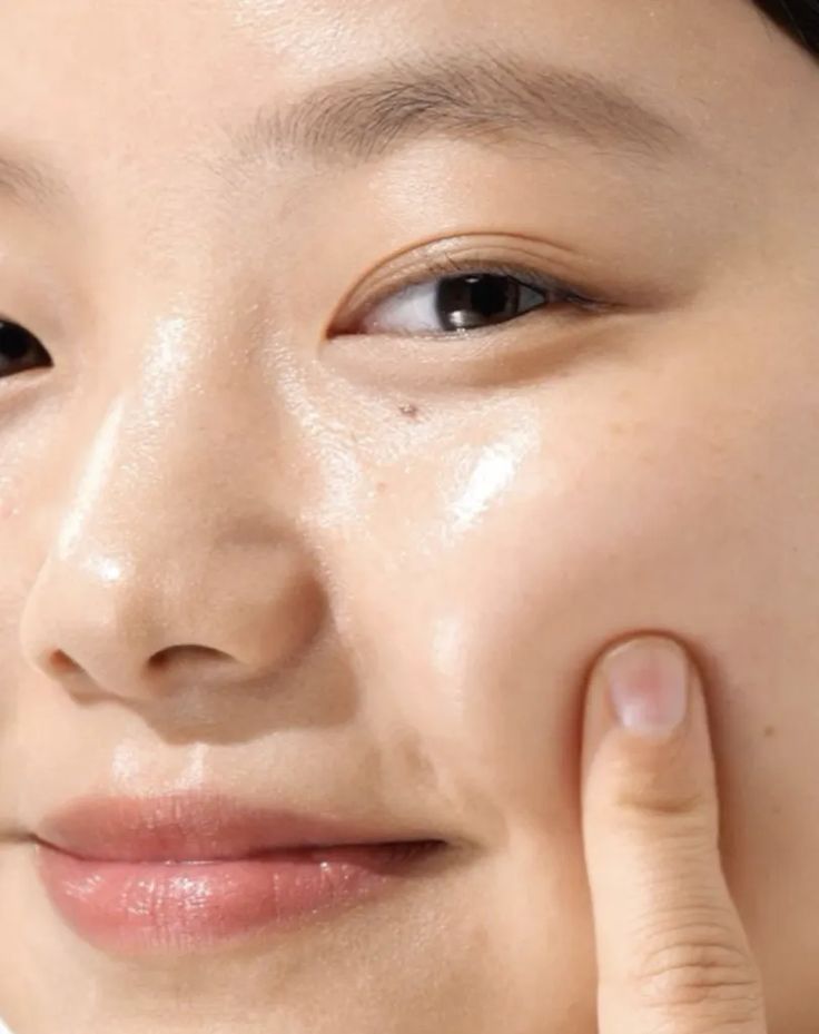 Mụn Hoài Không Hết. Vai Trò Của Niacinamide