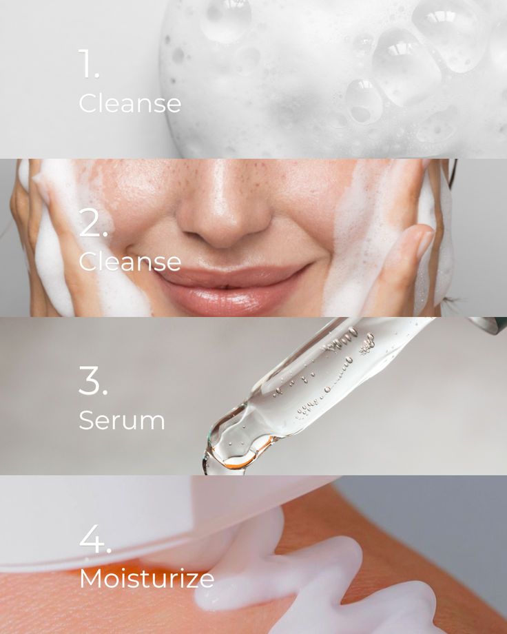 Routine Skincare Cho Da Đang Điều Trị Mụn