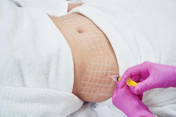 Sau Khi Tiêm Tan Mỡ Nên Chăm Sóc Như Thế Nào