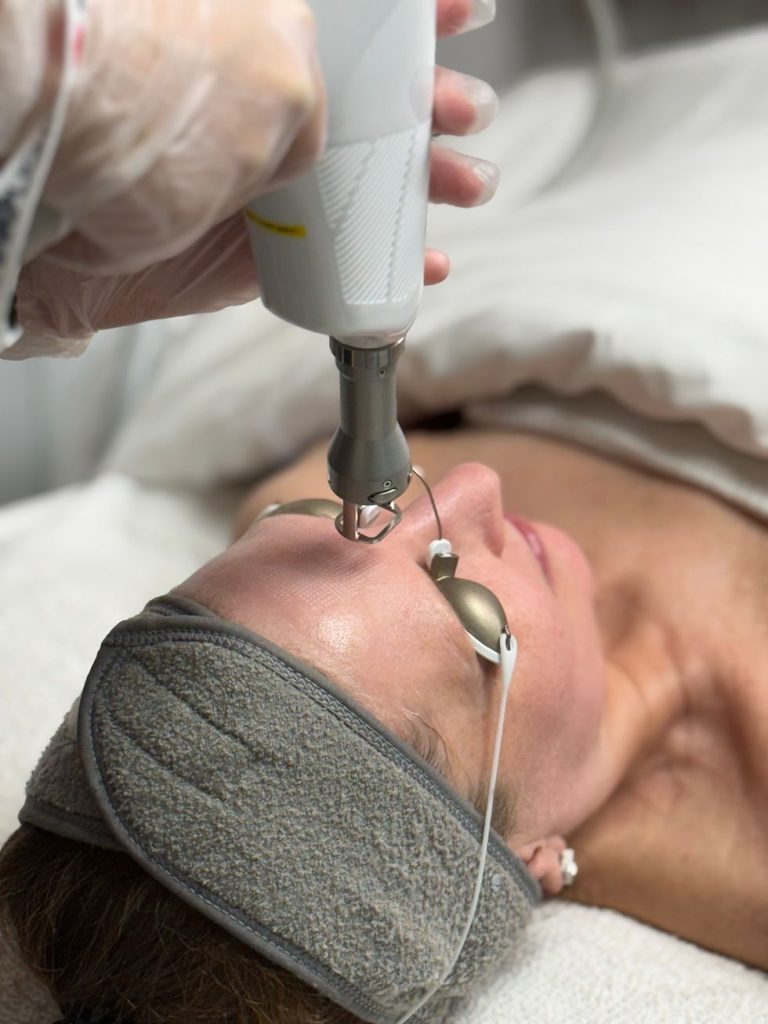 Trị Tàn Nhang Bằng Laser Có Hiệu Quả Không