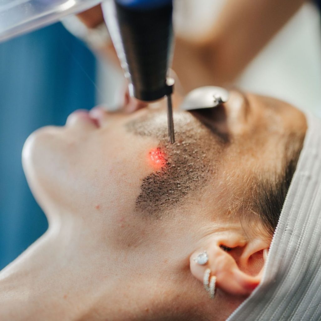 Trị Tàn Nhang Bằng Laser Có Hiệu Quả Không