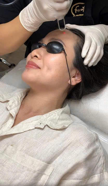 Quy Trình Laser Toning Chuẩn Y Khoa Diễn Ra Như Thế Nào