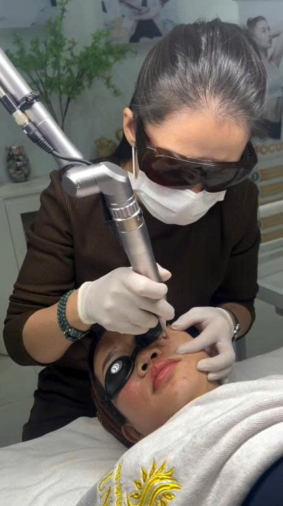 Quy Trình Laser Toning Chuẩn Y Khoa Diễn Ra Như Thế Nào