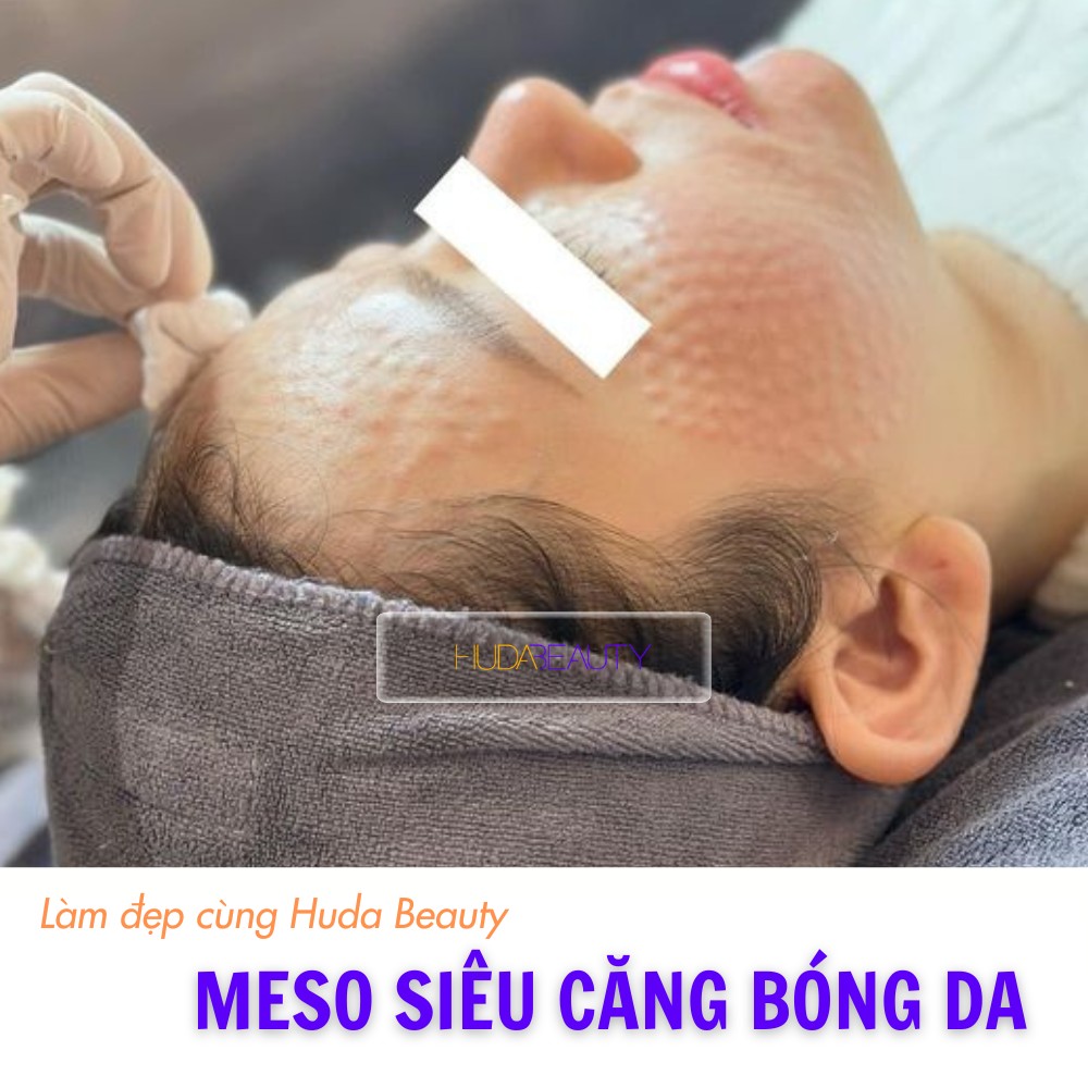 Cách giữ hiệu quả meso lâu hơn