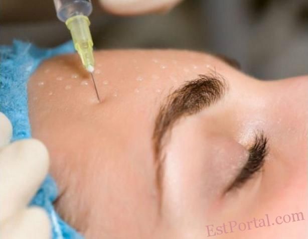 Tiêm Meso Có Thể Trẻ Hơn Bao Nhiêu Tuổi