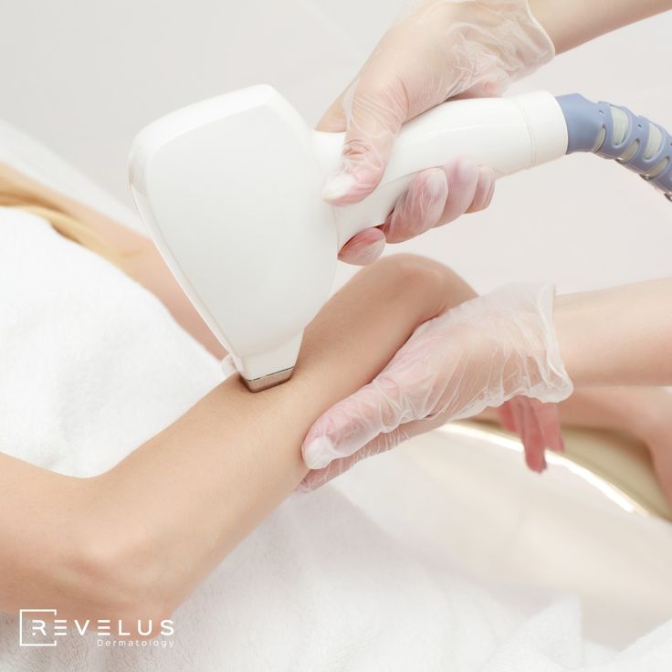 Triệt lông có mọc lại dày hơn