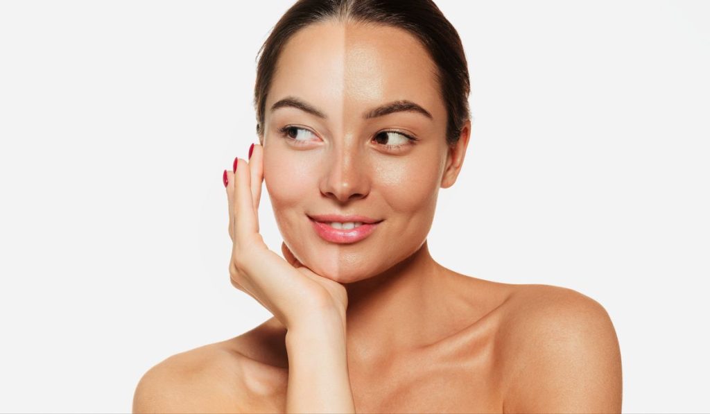 Vì sao da sạm nắng mãi không cải thiện