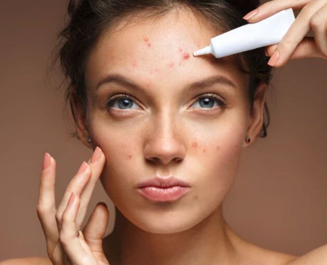 Bị Mụn Bọc Nên Ăn Gì Và Kiêng Gì