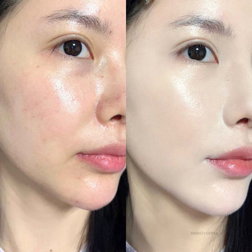 Bí Quyết Kiểm Soát Dầu Nhưng Ít Người Áp Dụng Đúng