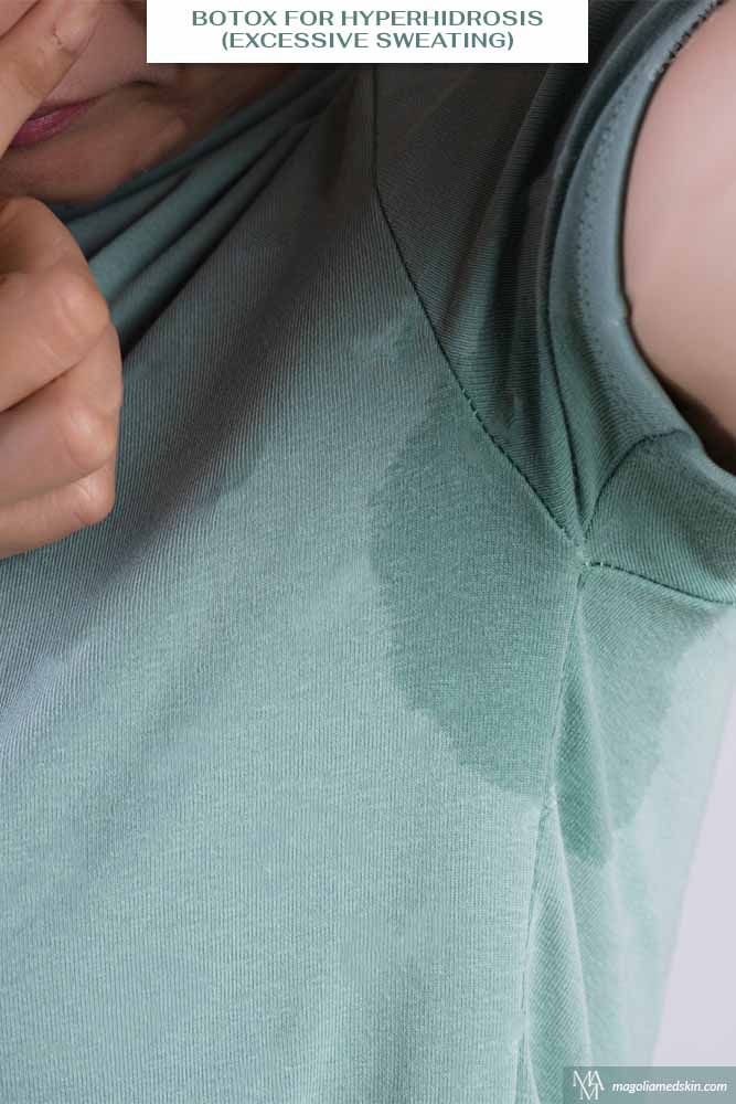 Đừng để mồ hôi làm khổ bạn: 5 mẹo trị hăm da và mùi cơ thể cho người quá khổ mùa nắng nóng