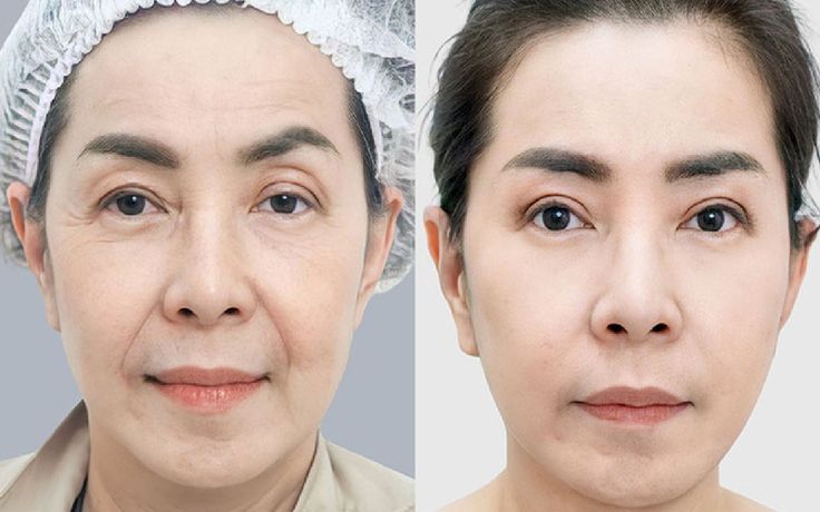 Vì Sao Gương Mặt Ngày Càng Hốc Hác, Kém Sức Sống