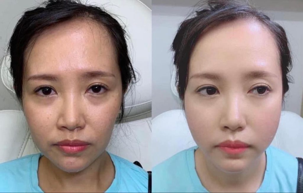 Vì Sao Gương Mặt Ngày Càng Hốc Hác, Kém Sức Sống