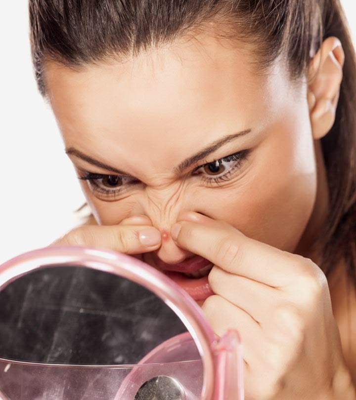 Sợi Bã Nhờn Là Gì. Cách Phân Biệt Và Xử Lý Dứt Điểm Chuẩn Y Khoa