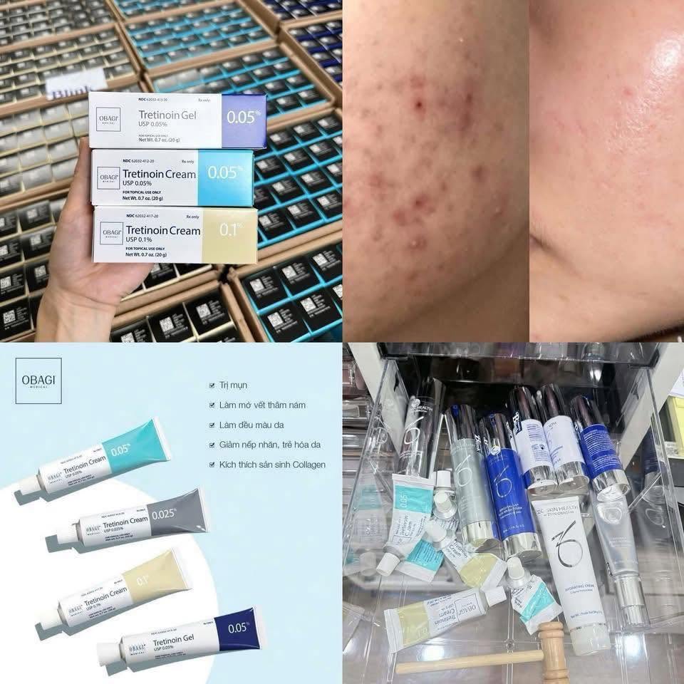 Tretinoin Loại Nào Tốt Nhất Cho Da Mụn